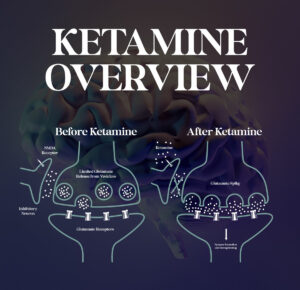 How Ketamine Works