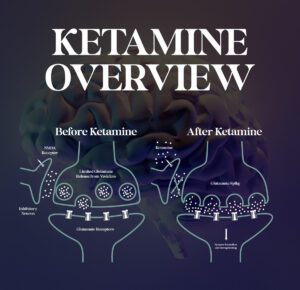 How Ketamine Treatment Works