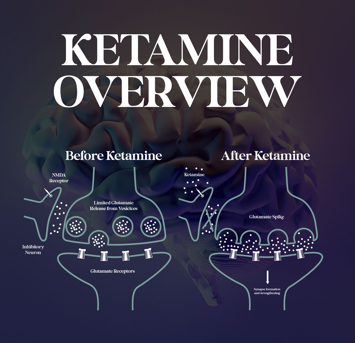 KetamineOverview How Ketamine Works